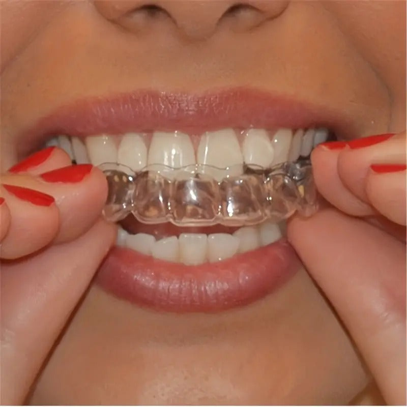Invisible Braces Whitening Gel